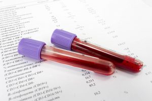 Santa Barbara Fertility Center Infectious Disease Testing